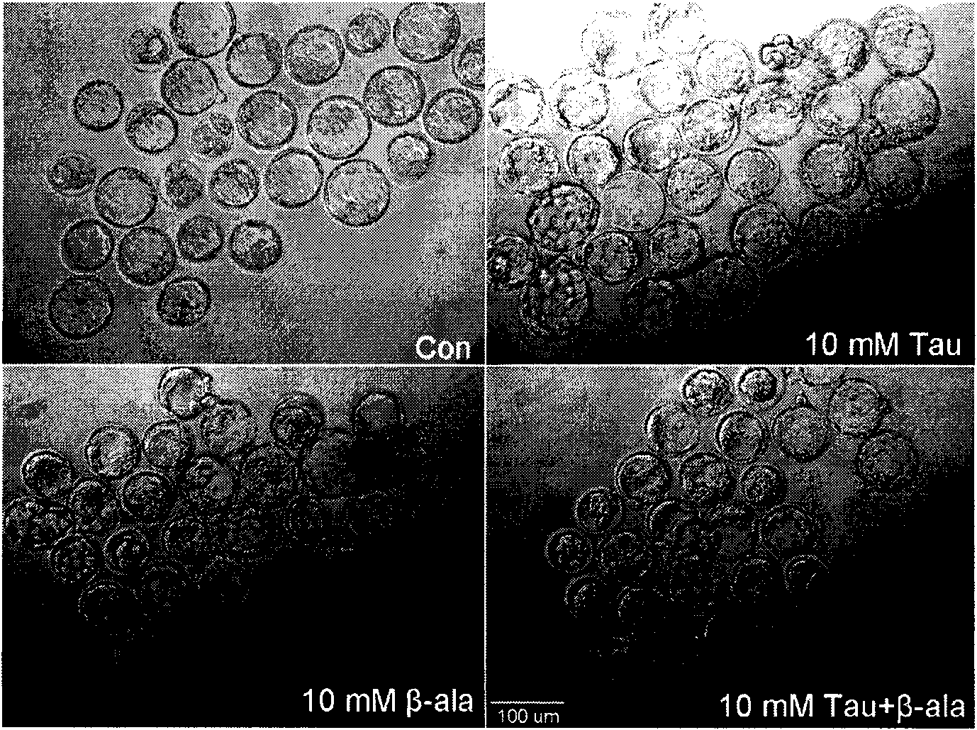 Application of taurine and pharmaceutically acceptable salt thereof to preparing uterine contraction inhibition drug