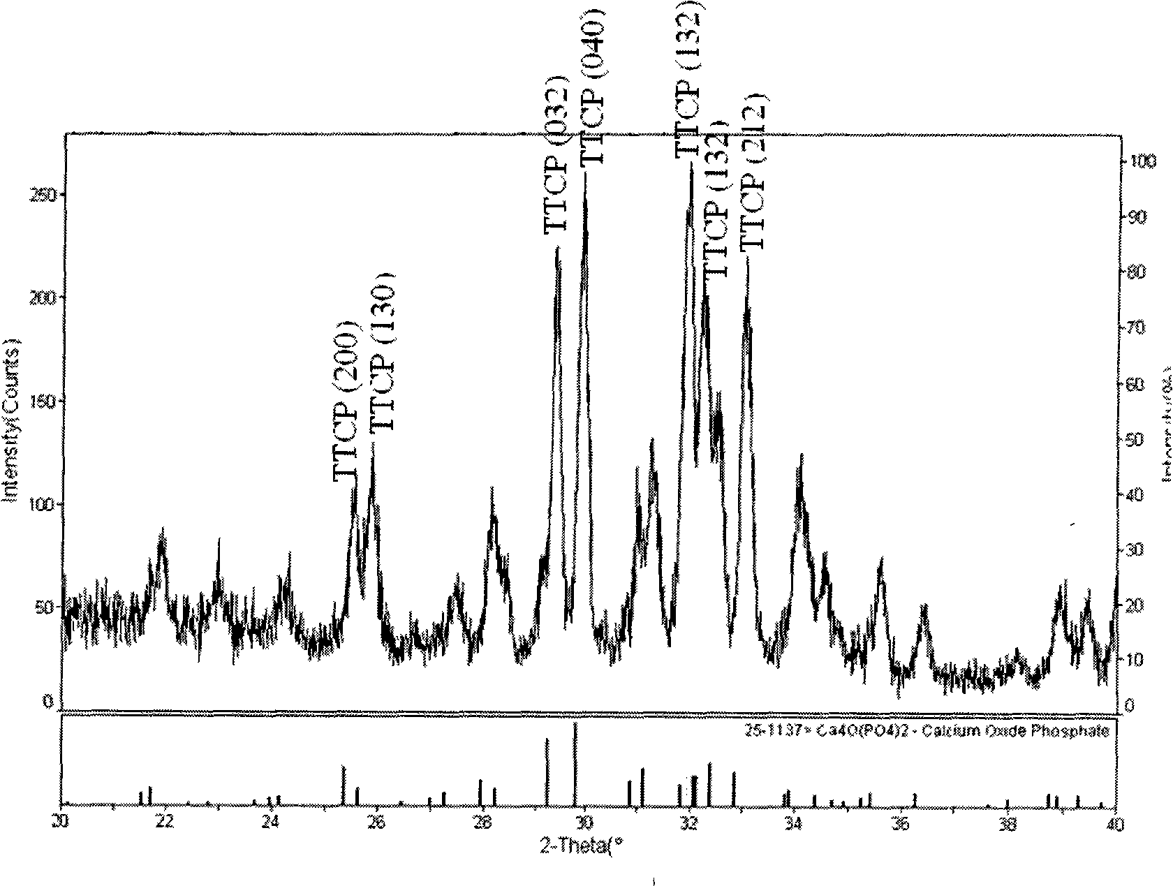 Bone cement with biological decomposability and preparation method thereof