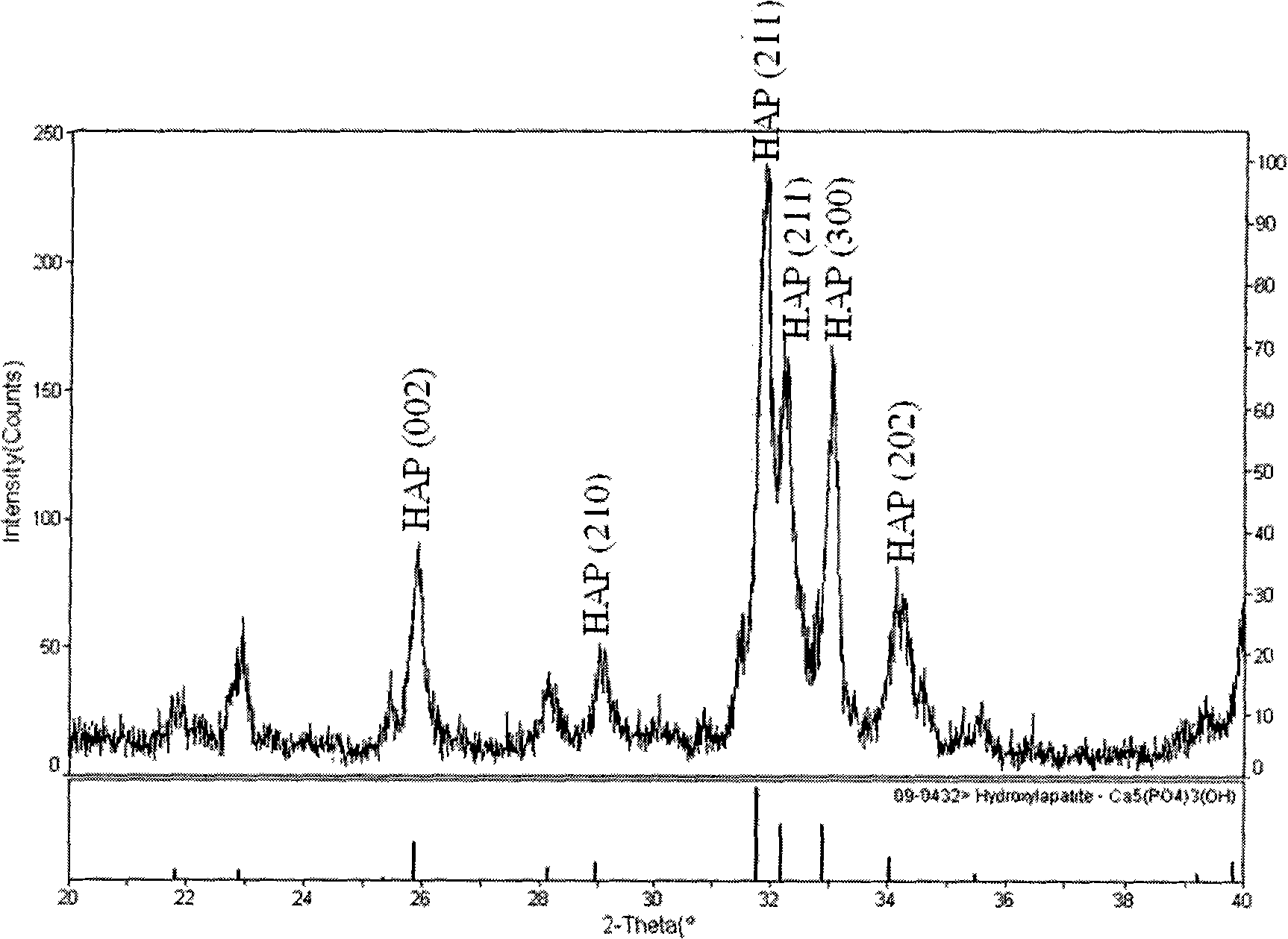 Bone cement with biological decomposability and preparation method thereof