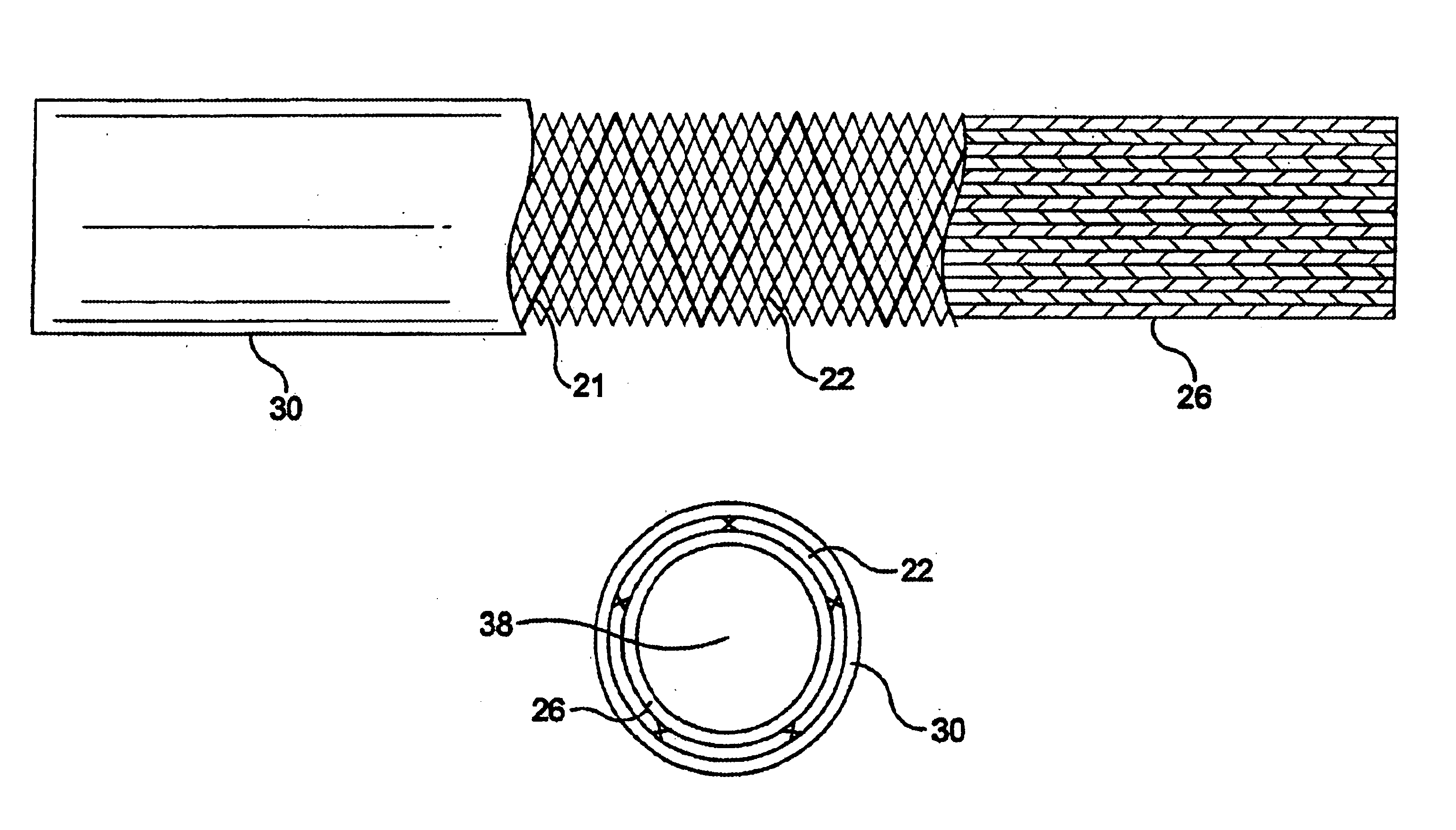 Stent-graft-membrane and method of making the same