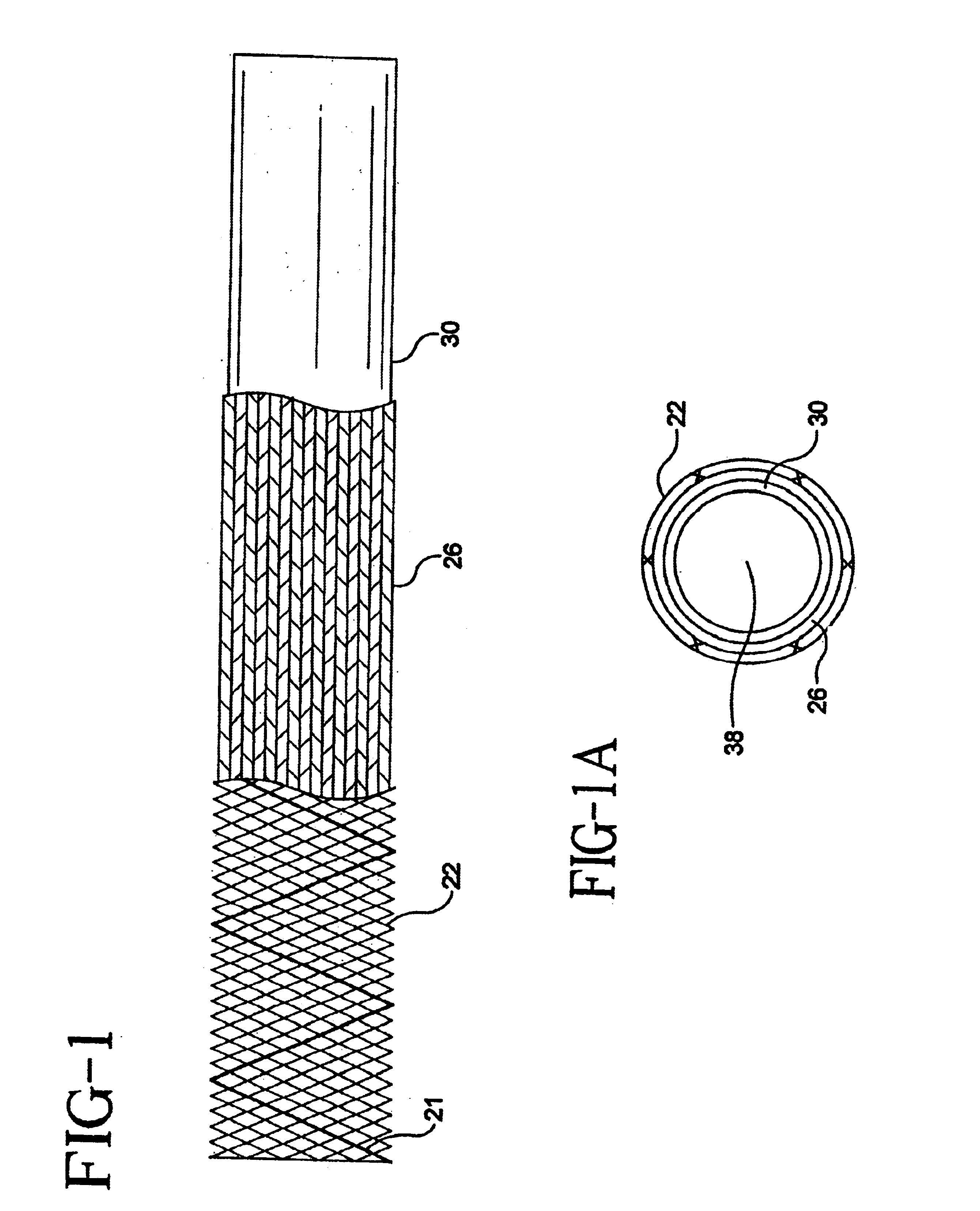 Stent-graft-membrane and method of making the same