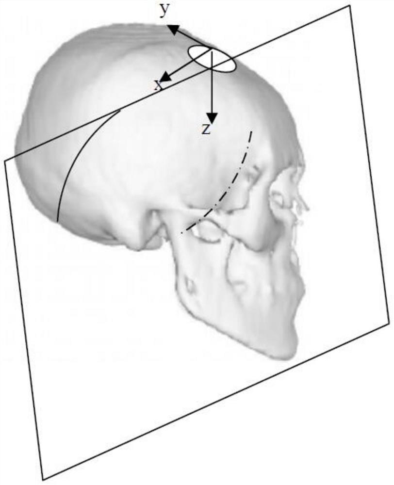 Method for automatically detecting and displaying ultrasonic craniocerebral abnormal region