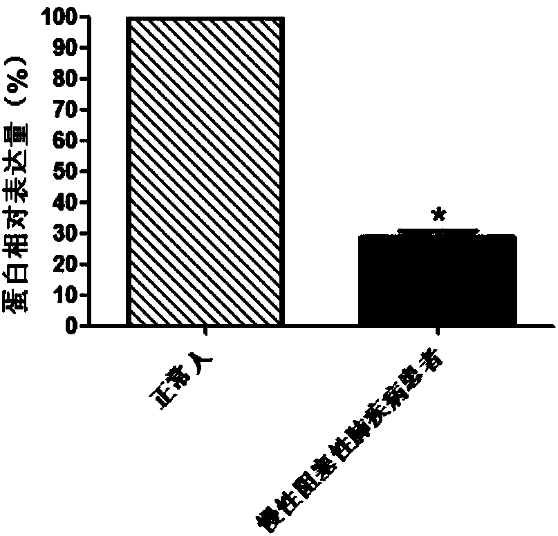 SHISA4 serving as biomarker for early diagnosis of chronic obstructive pulmonary disease