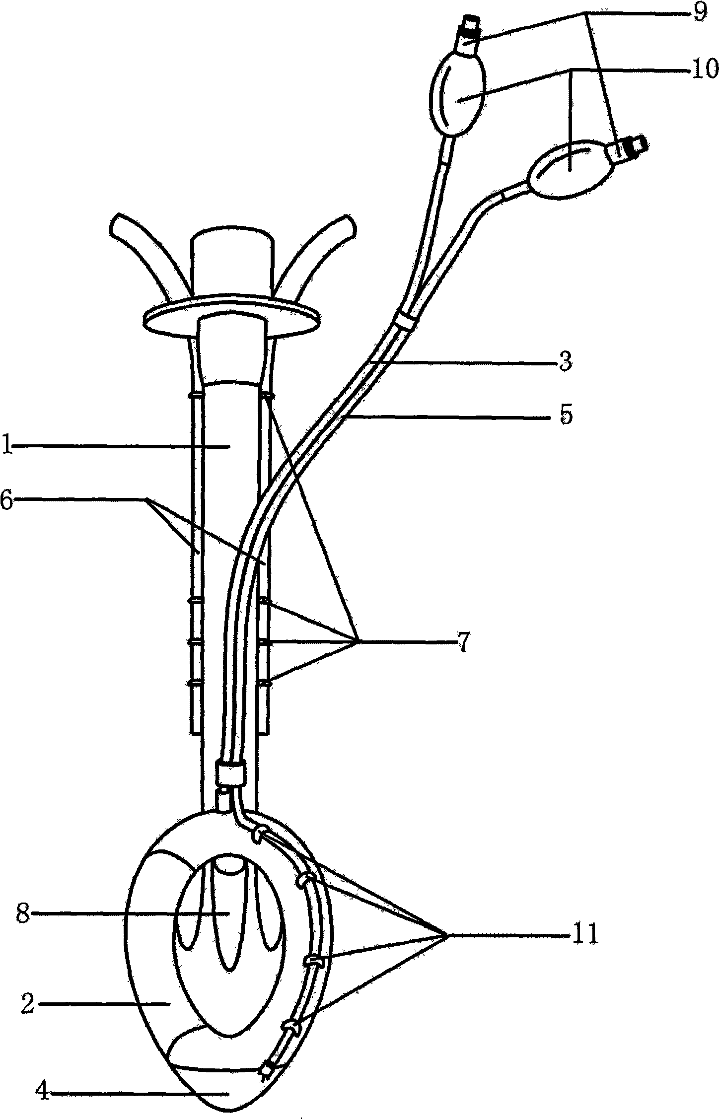 Transesophageal examination laryngeal mask