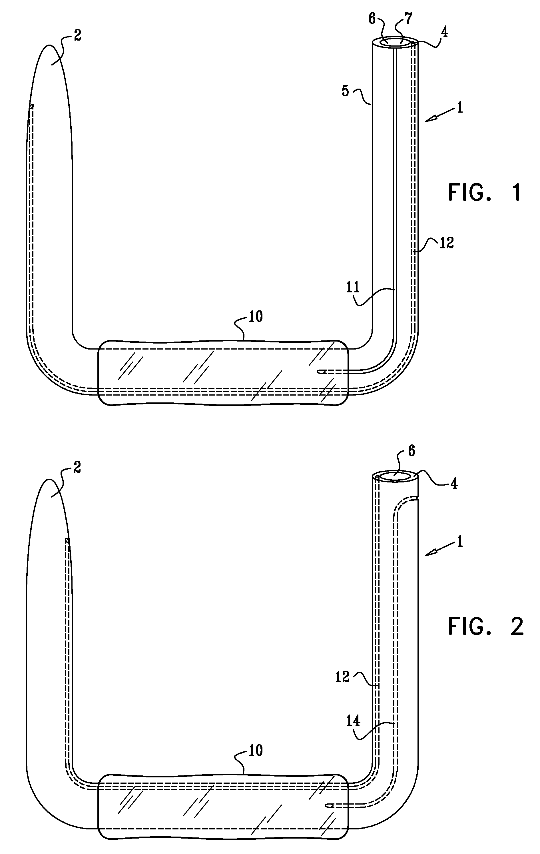 Floating gastrointestinal anchor