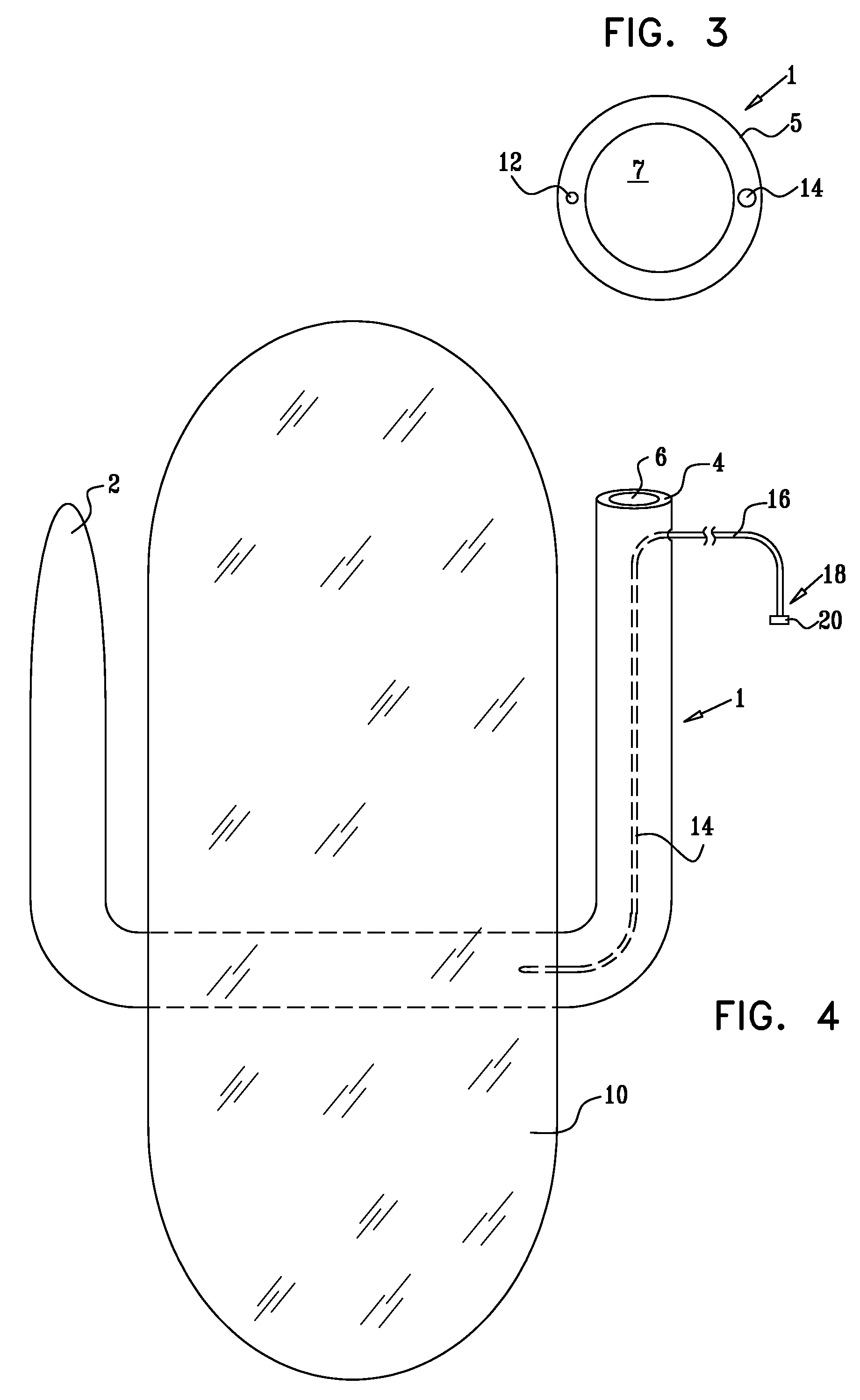 Floating gastrointestinal anchor