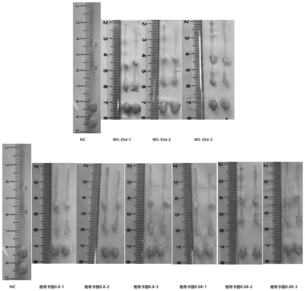 Application of dibucaine in preparation of medicine for treating spermatogenic dysfunction