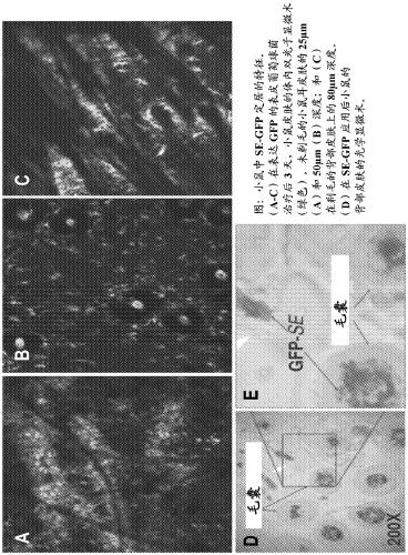 Methods and compositions for treating inflammatory skin disease with recombinant microorganisms