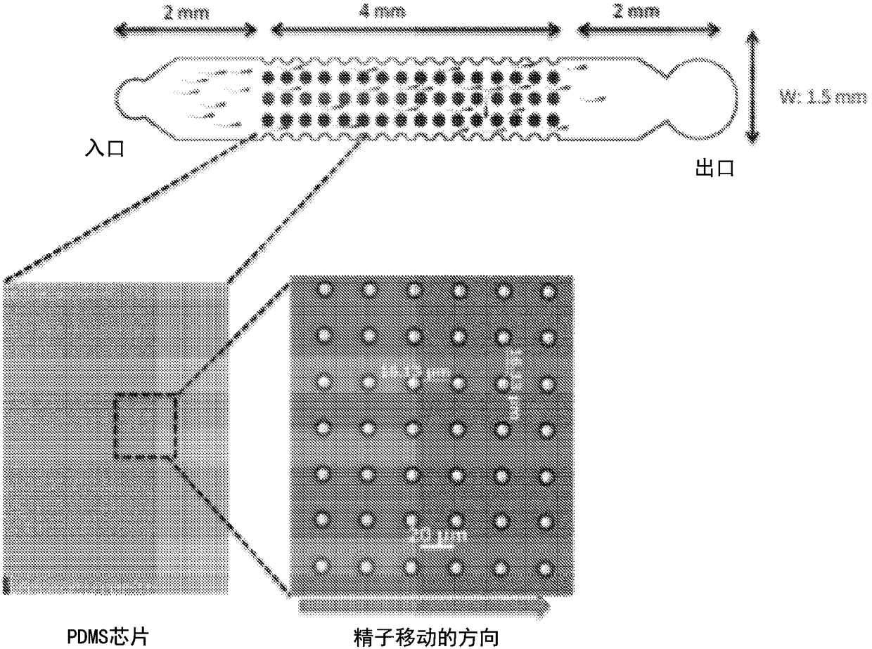 A micro-fluidic device for selective sorting of highly motile and morphologically normal sperm from unprocessed semen