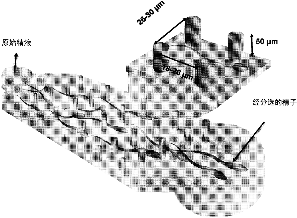 A micro-fluidic device for selective sorting of highly motile and morphologically normal sperm from unprocessed semen