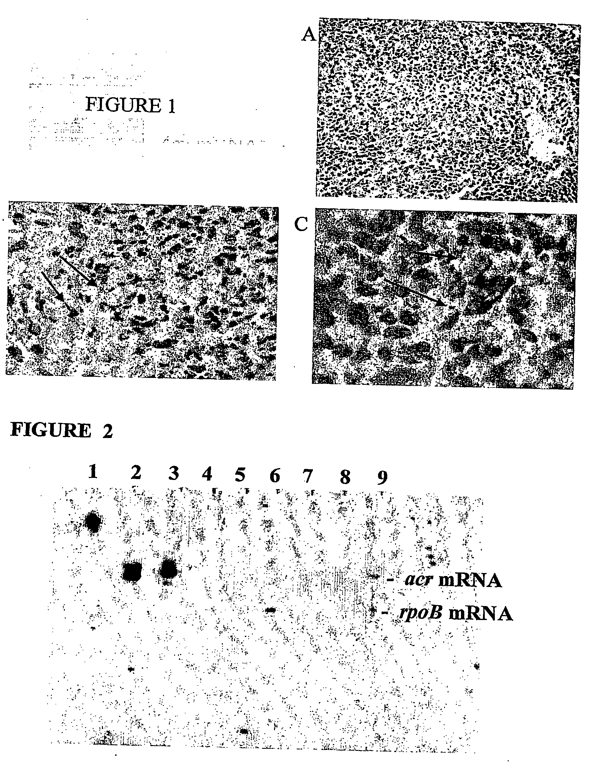 Latent human tuberculosis model, diagnostic antigens, and methods of use