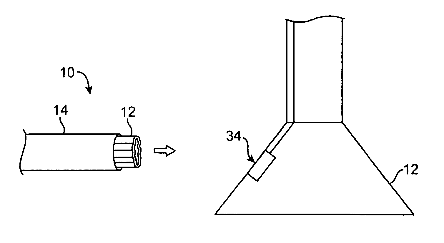 Visualization and ablation system variations