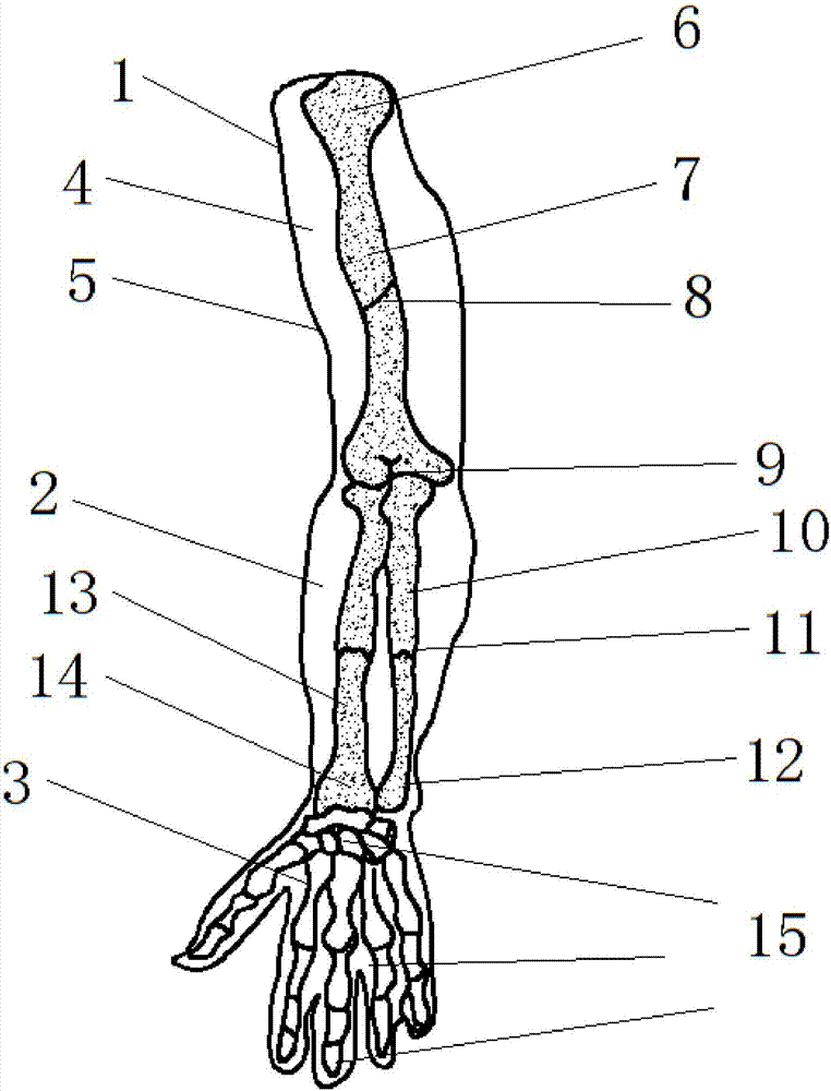 Multifunctional transparent upper limb fracture manual reposition training model