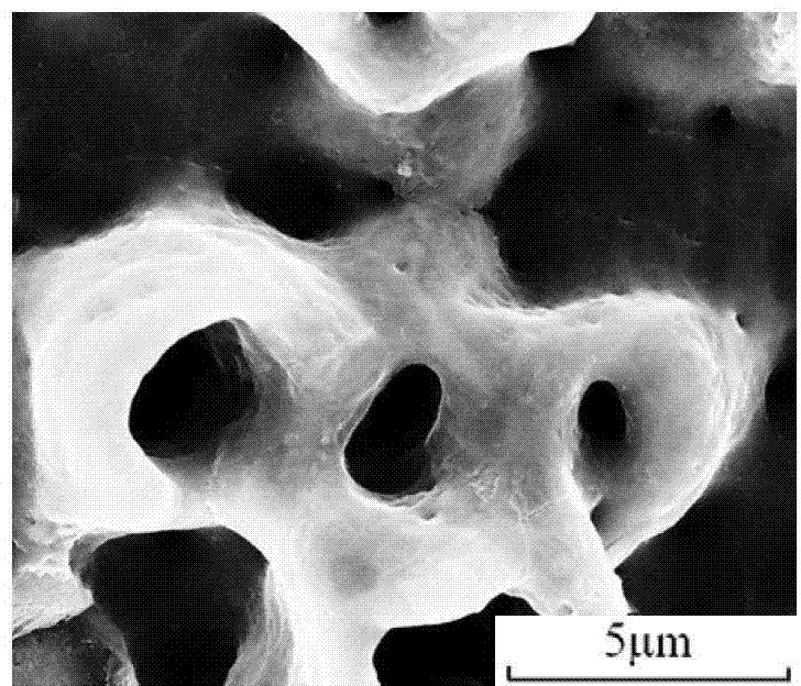 Method for preparing multistage micron structure on titanium implant surface