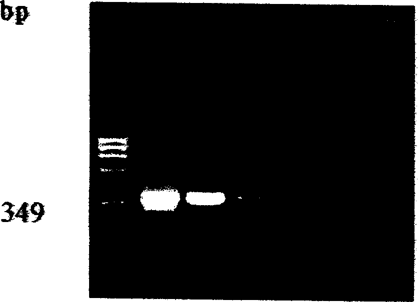 PCR kit for testing banana apical tuft virus and its test method