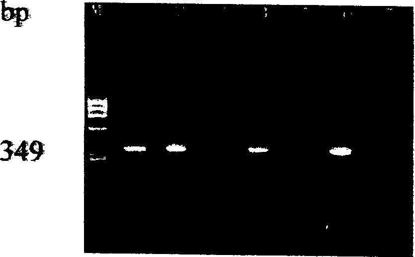 PCR kit for testing banana apical tuft virus and its test method