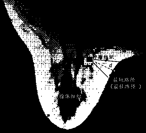 Design method of wearable microwave detecting antenna and antenna array based on medical images