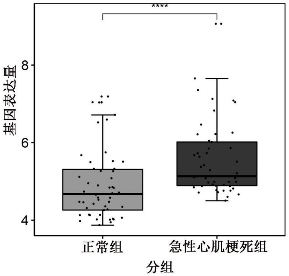 Biomarker for diagnosing and treating myocardial infarction