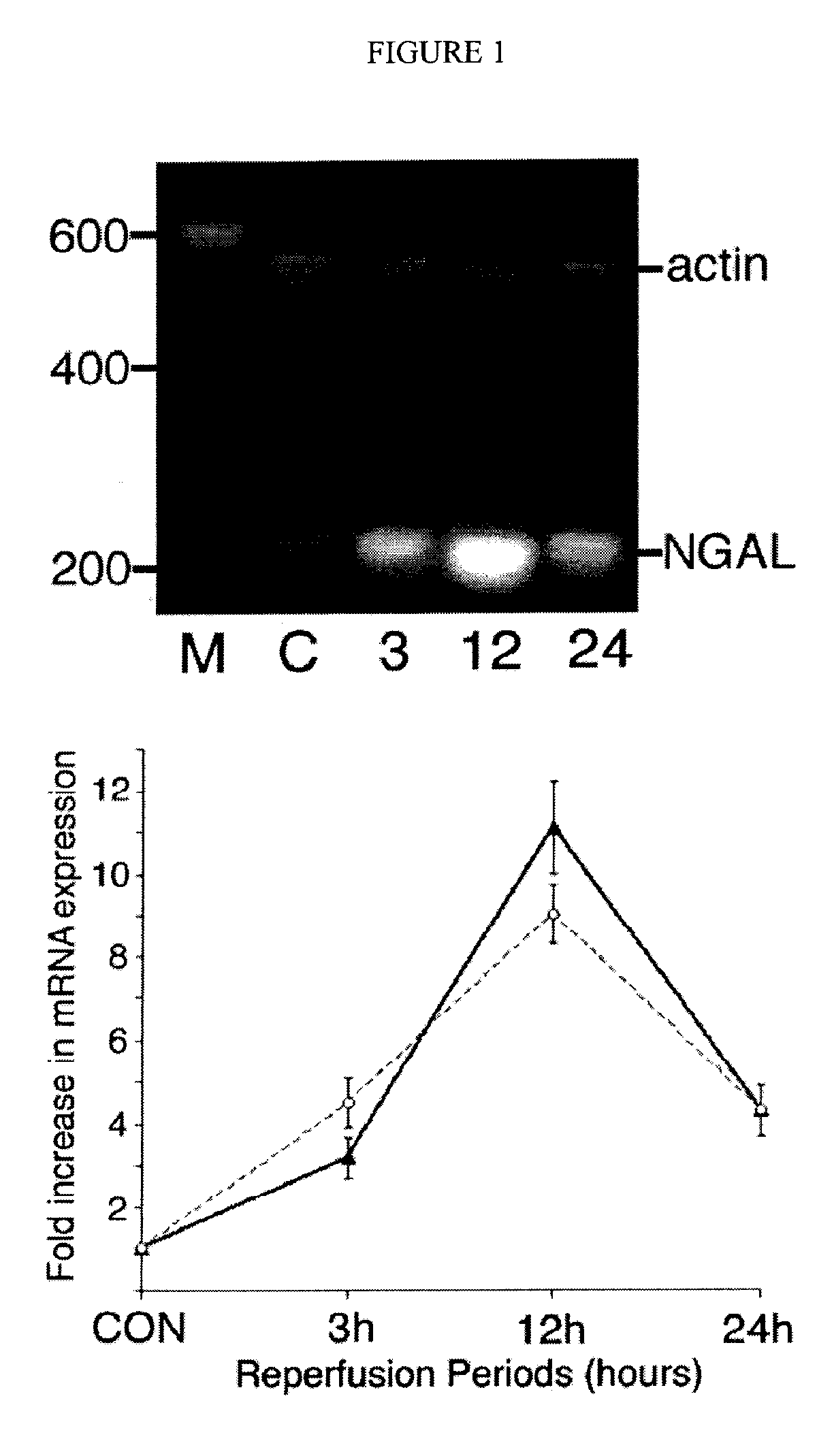 Method and kit for detecting the early onset of renal tubular cell injury