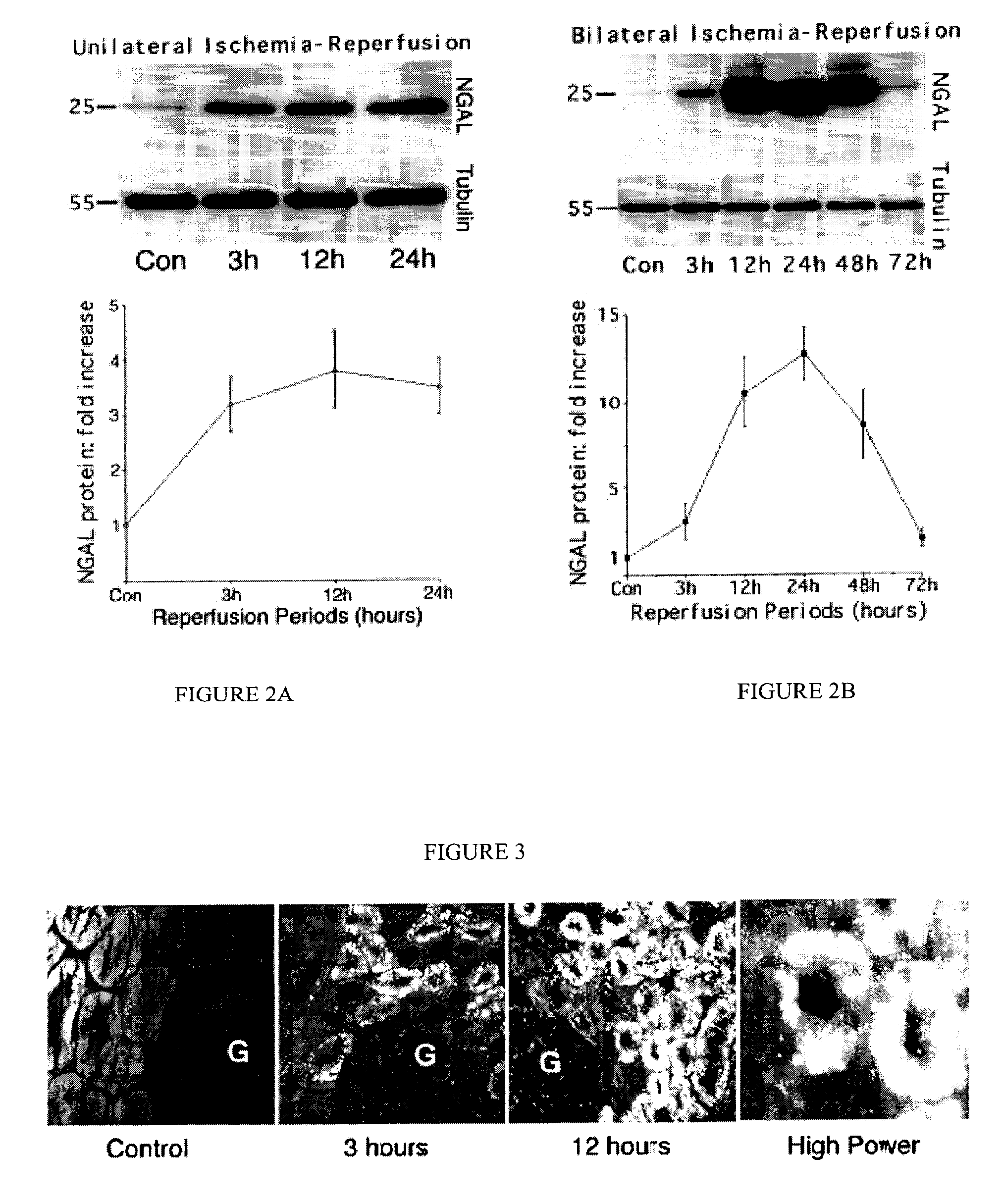 Method and kit for detecting the early onset of renal tubular cell injury