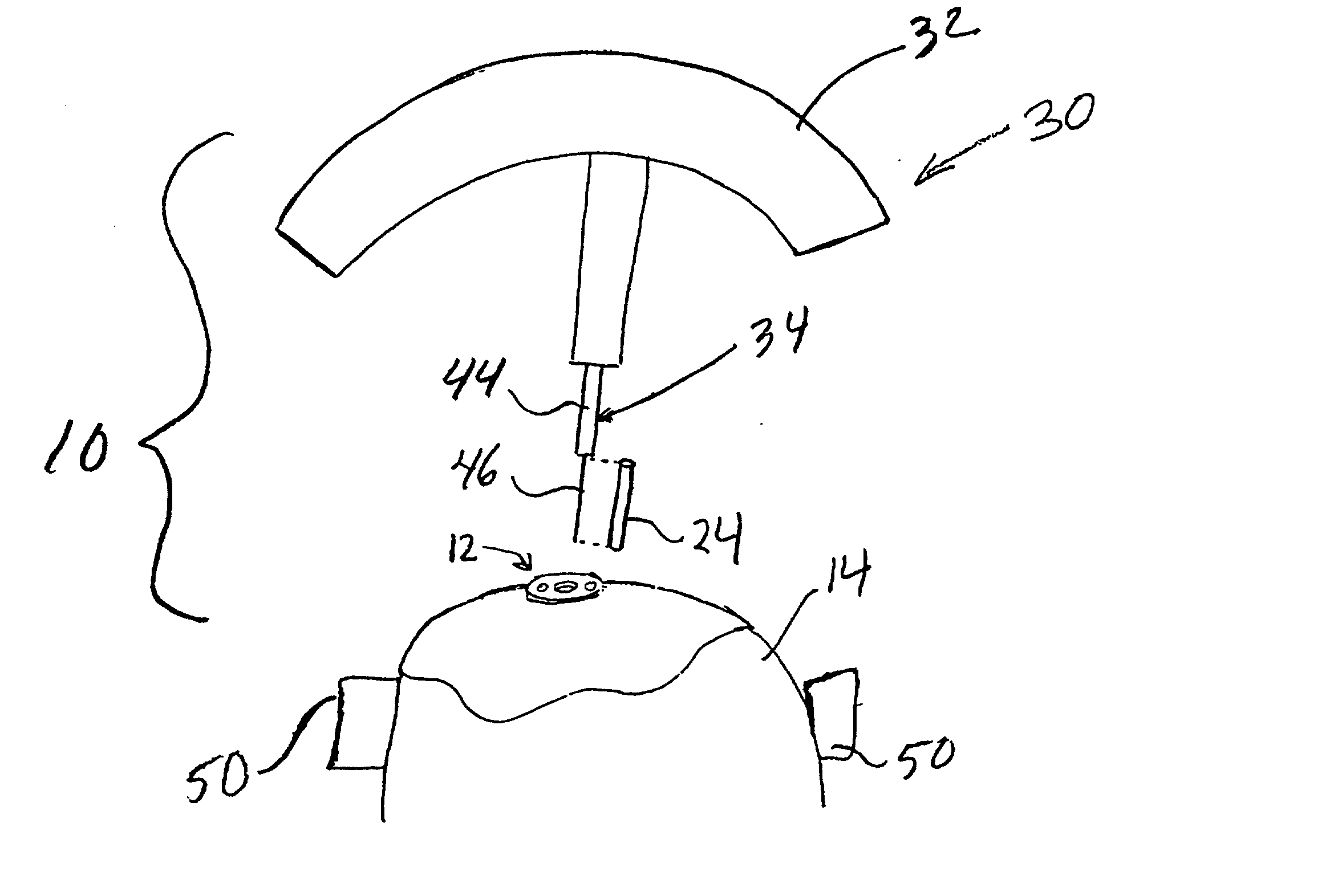 Stereotaxic detachable needle extension