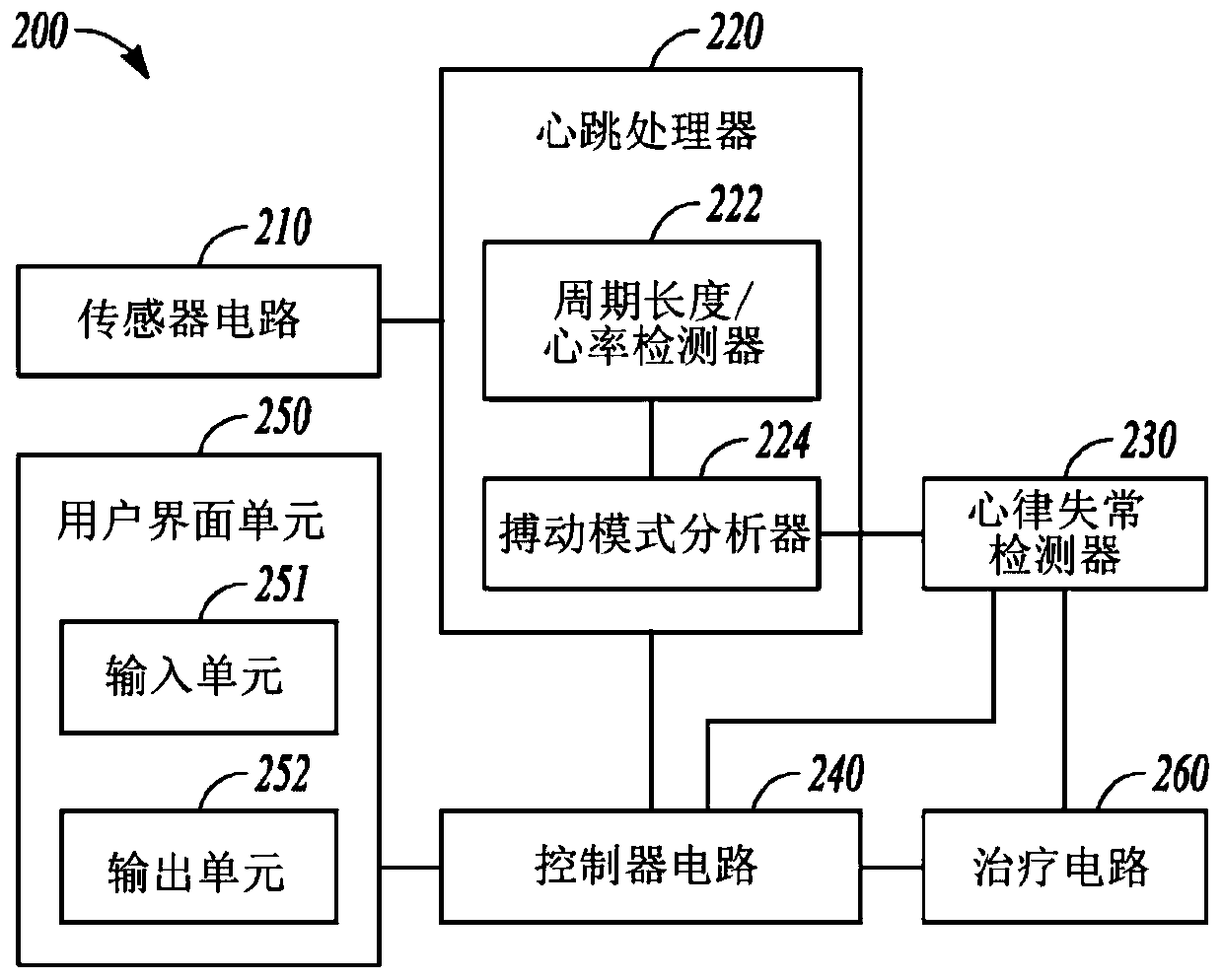 System for arrhythmia detection