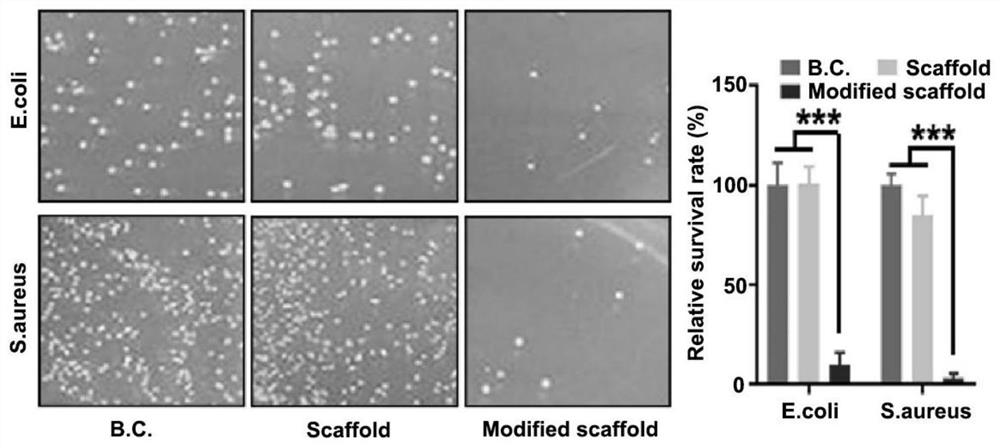 Universal modification method and application of metal tracheal scaffold material