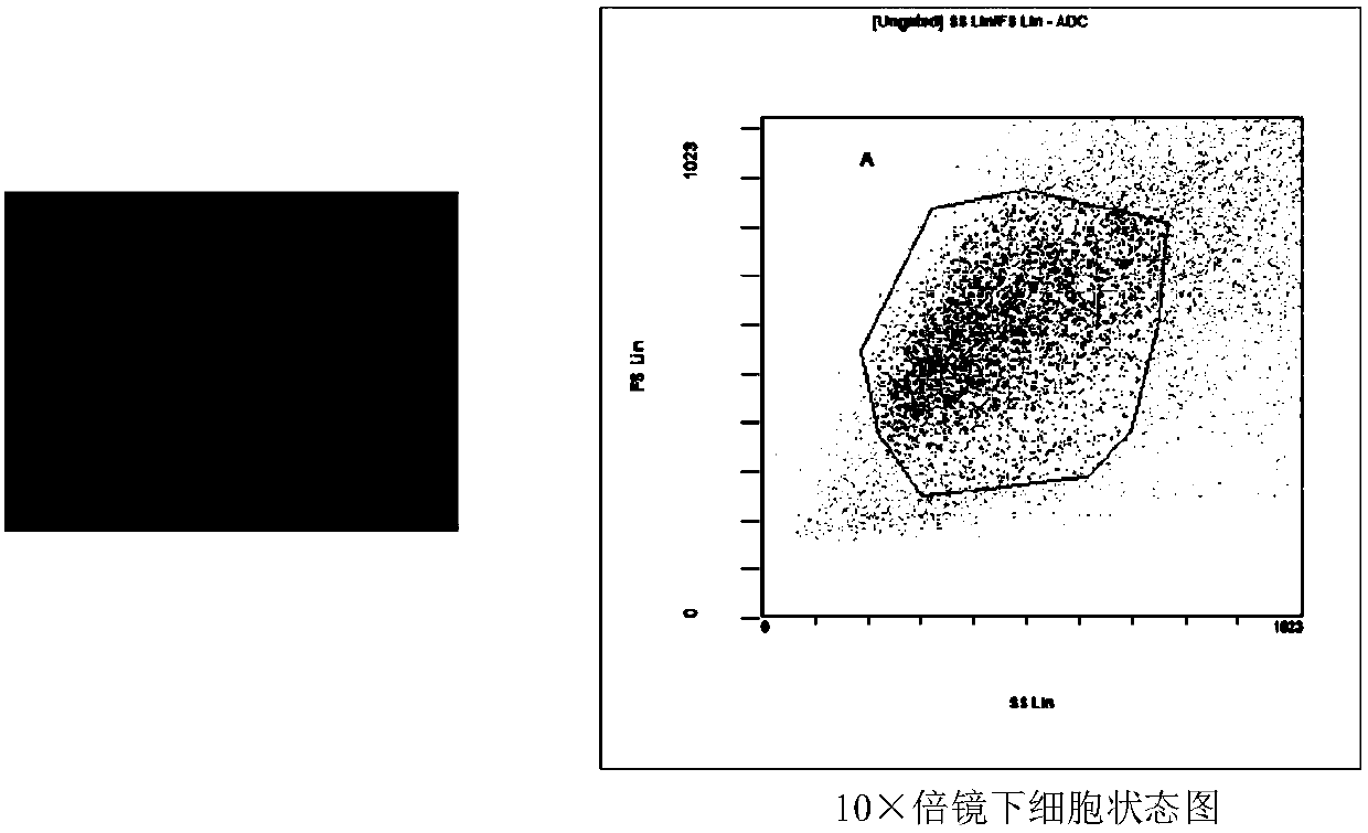 Preparation method of mesenchymal stem cell expressing human-derived immune stimulating factor LIGHT and prepared MSC-L cell