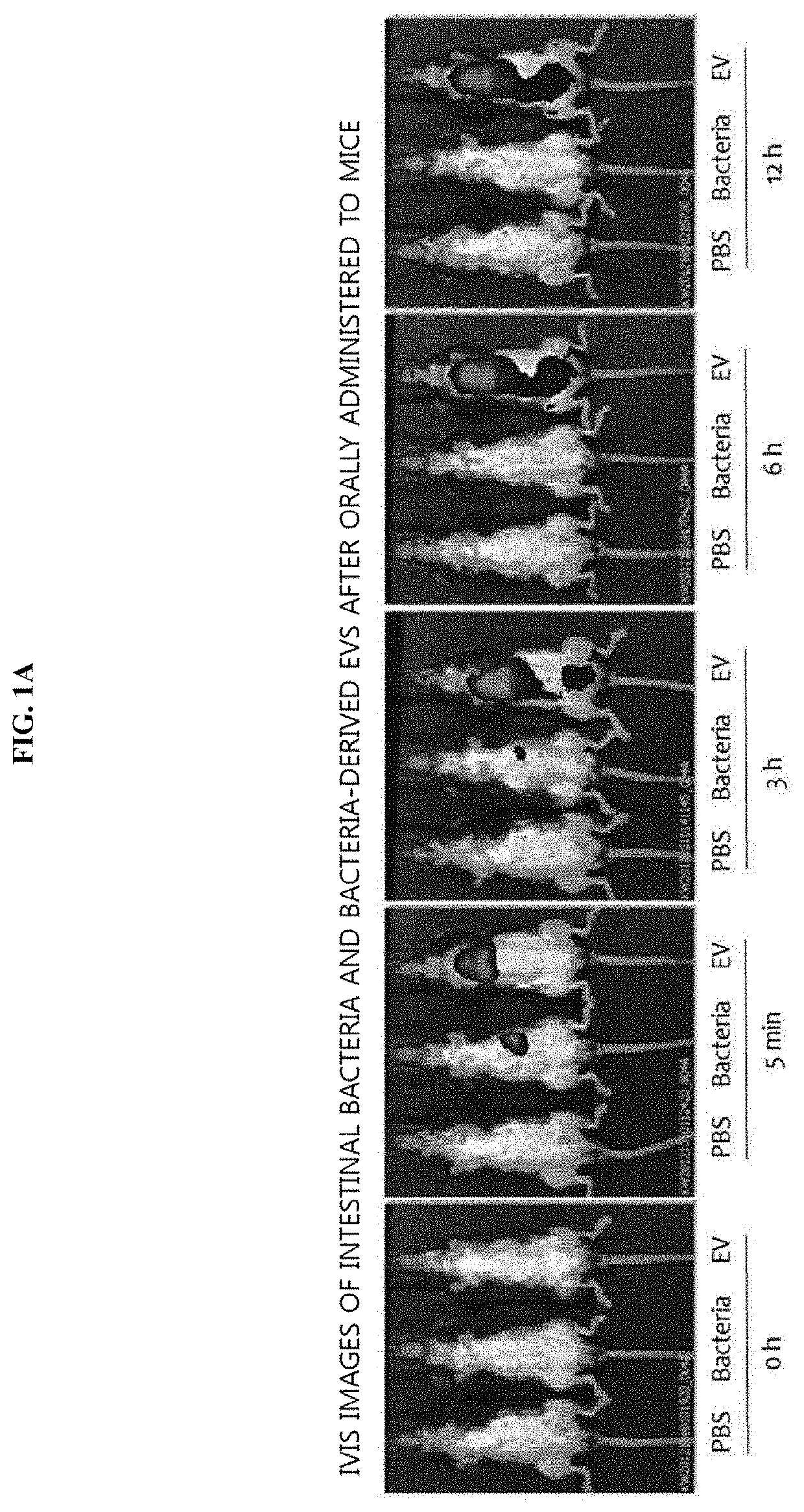 Method for diagnosis of stroke through bacterial metagenome analysis