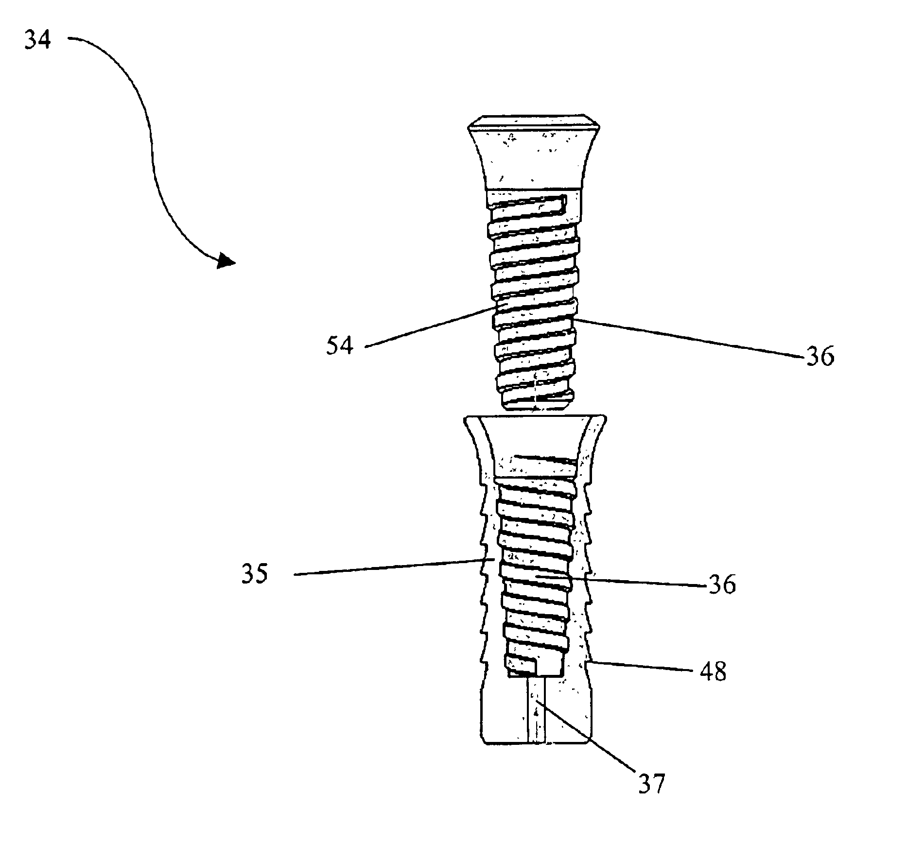 Expandable polymer dental implant and method of use