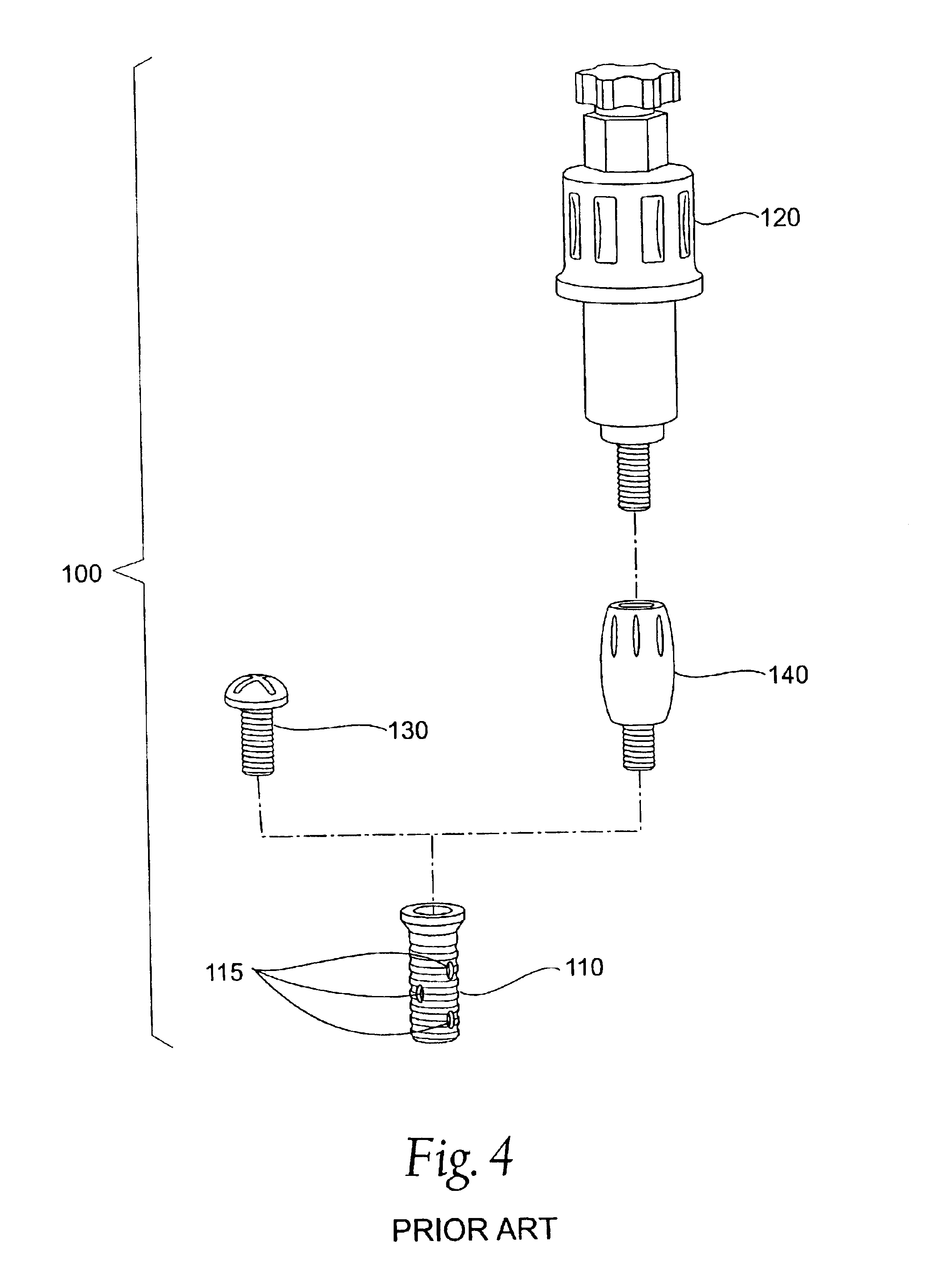 Expandable polymer dental implant and method of use