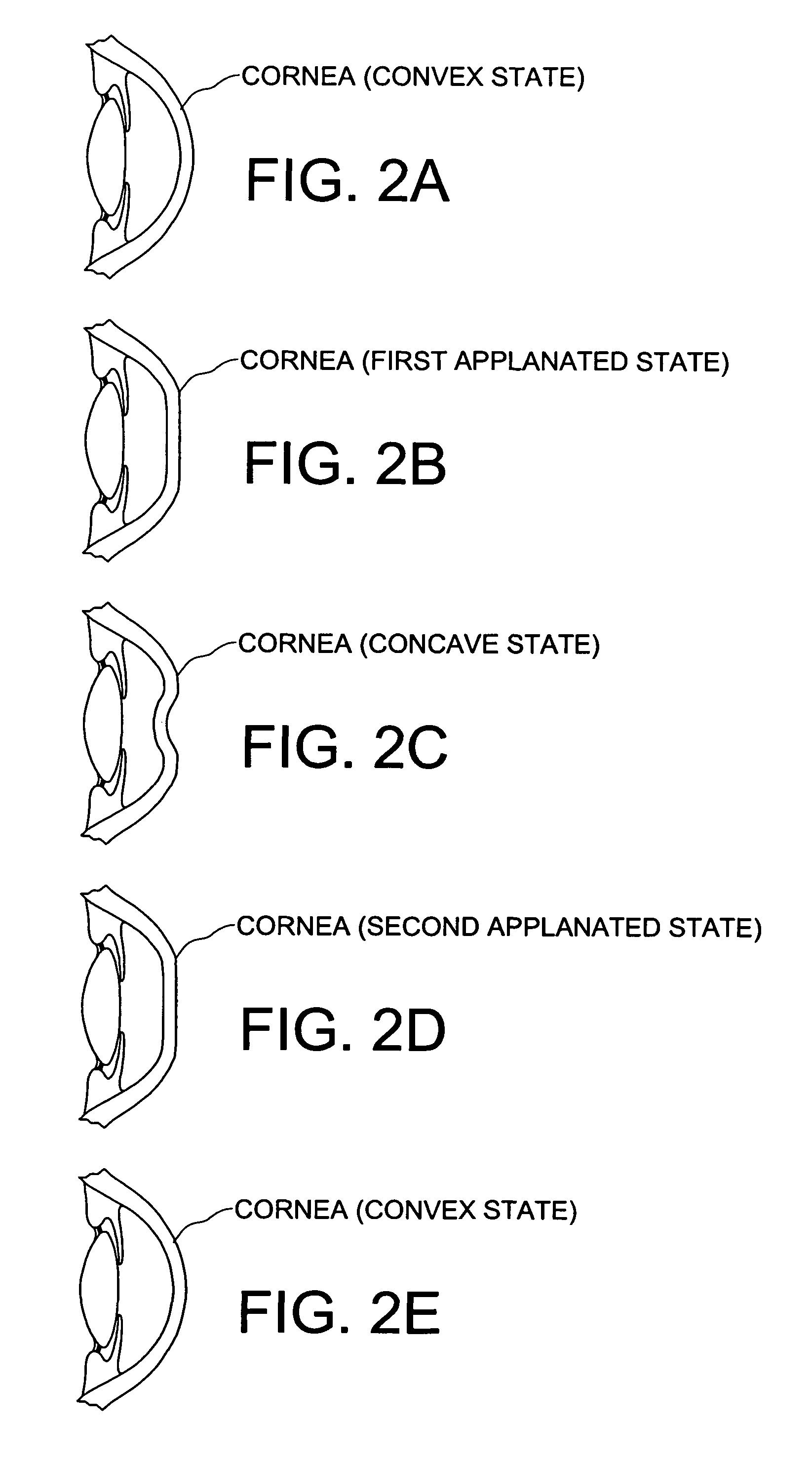 Method and apparatus for measuring corneal resistance