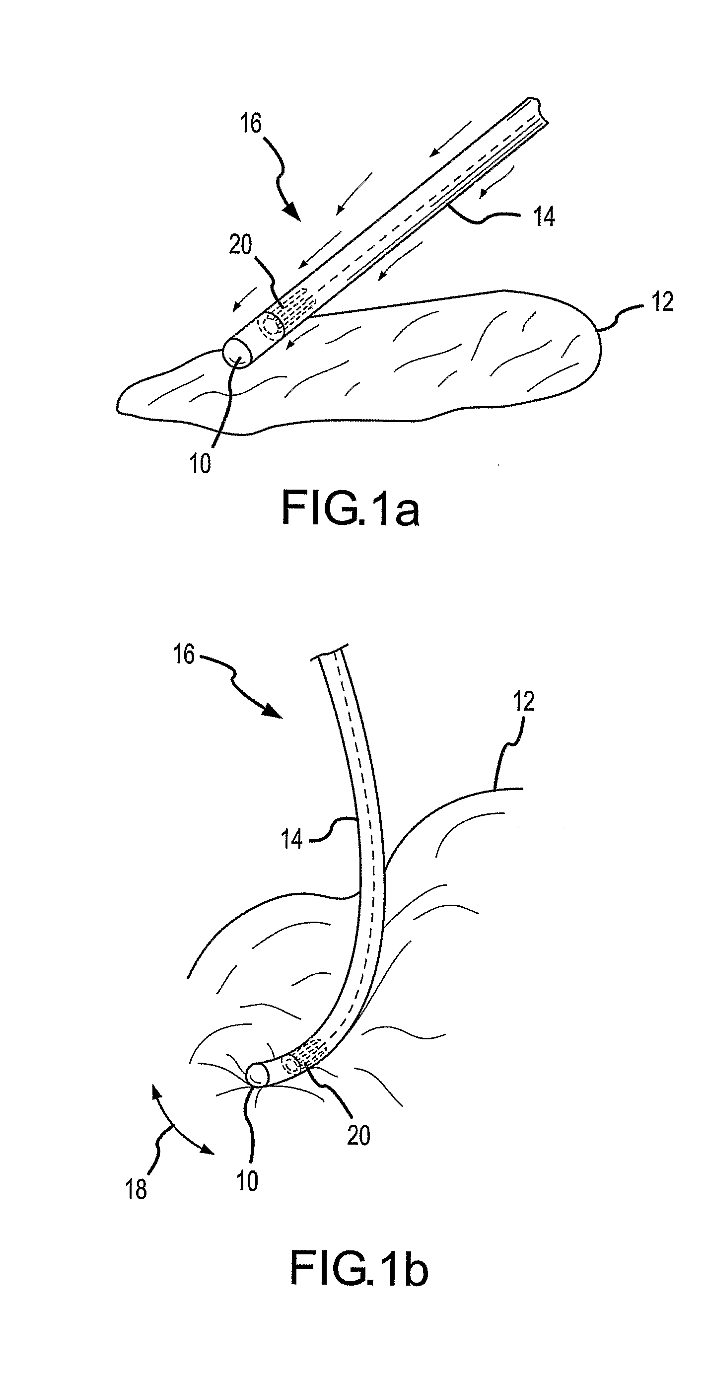 Systems and Methods for Electrode Contact Assessment