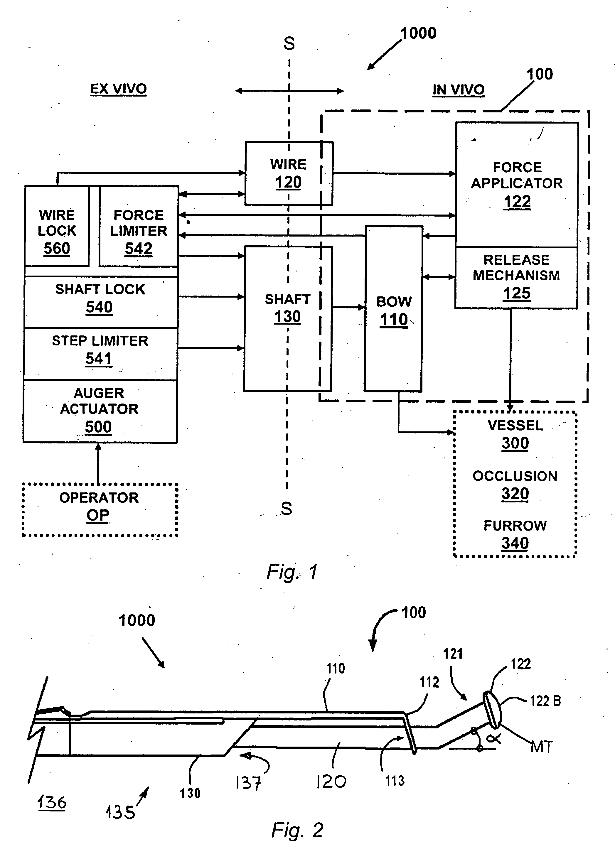 Blood vessel occlusion auger