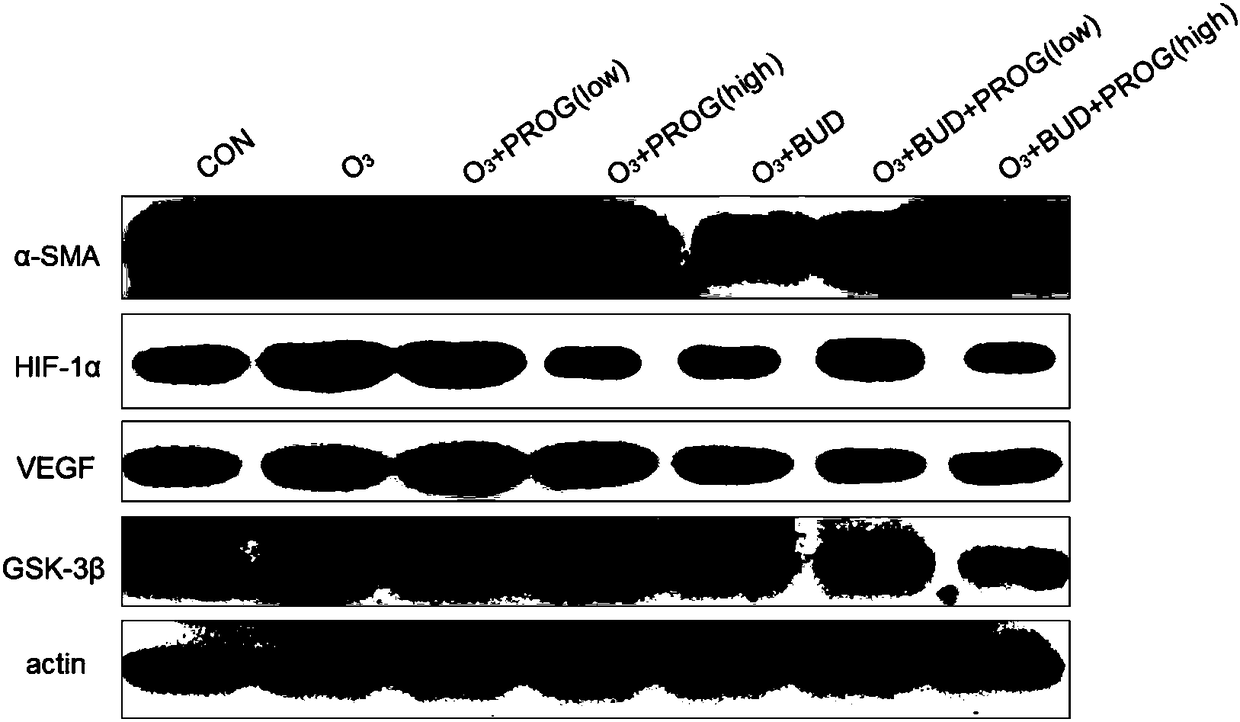 Application of progestational hormone in preparing glycogen synthase kinase-3beta inhibitor medicine, and glycogen synthase kinase-3beta inhibitor