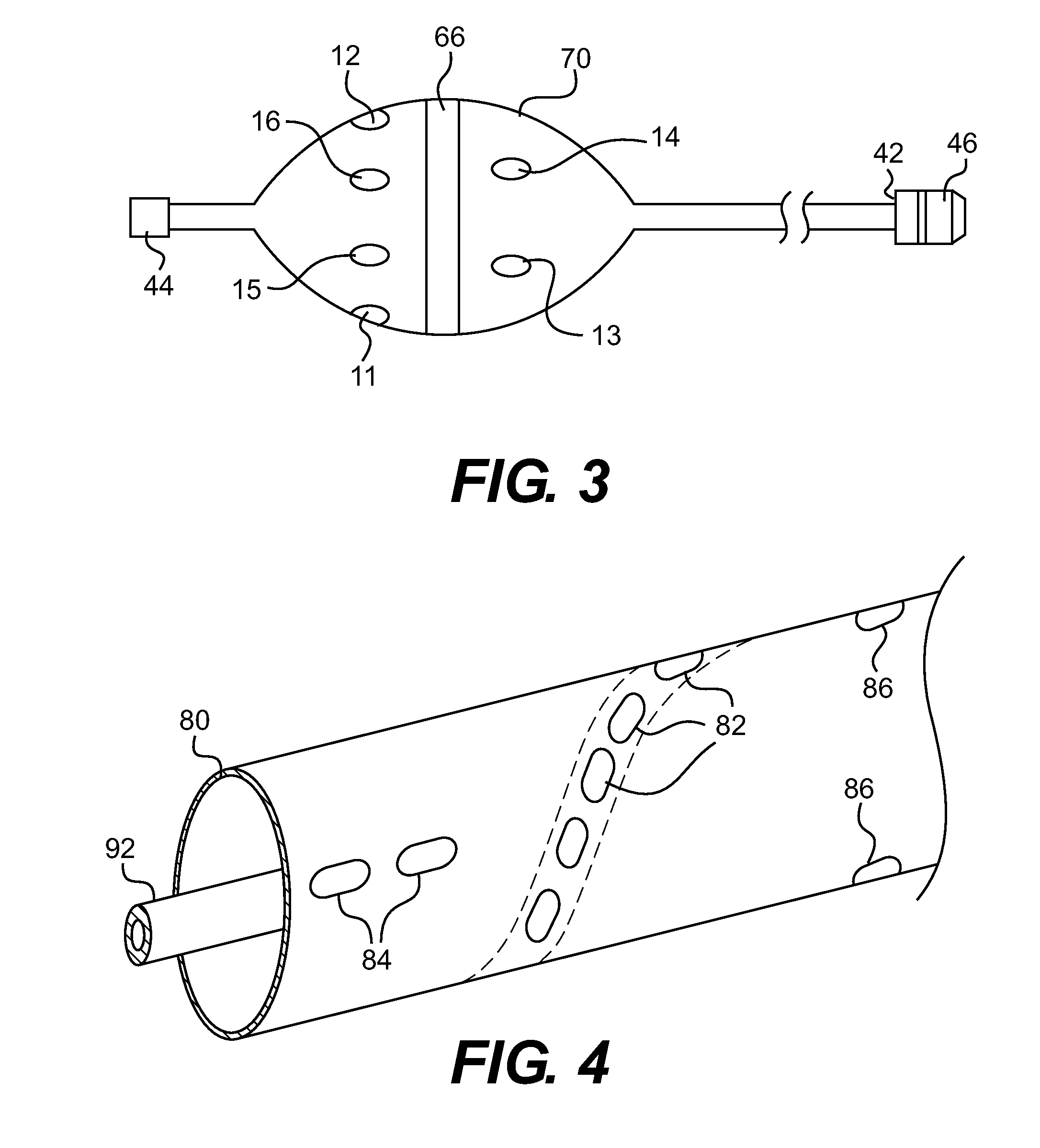 Method and apparatus of assessing transvascular denervation