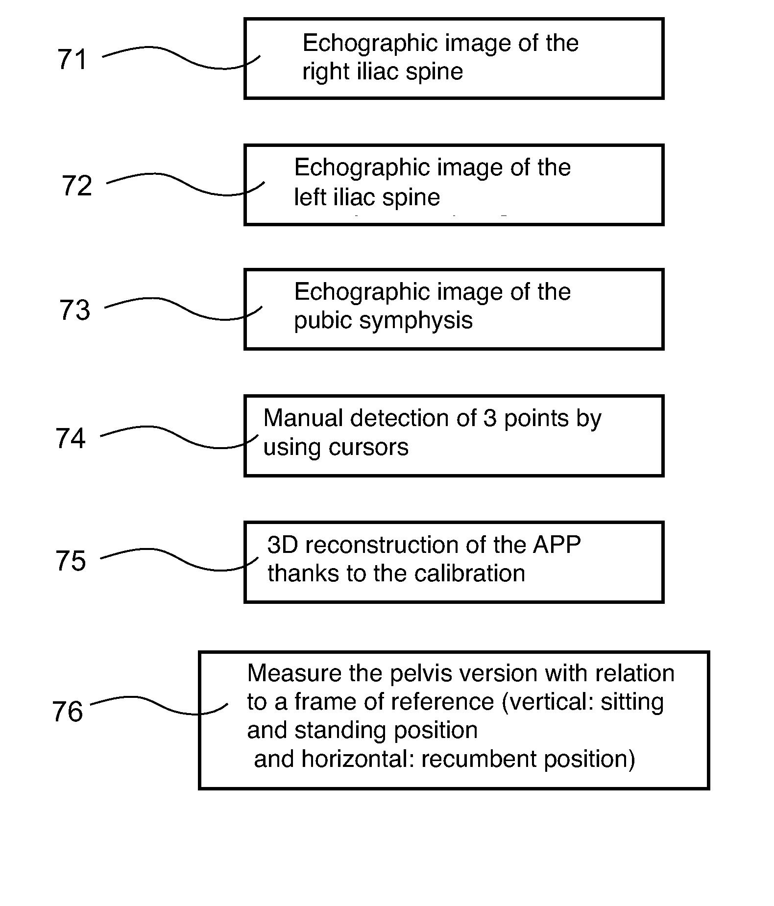 Help system for implanting a hip prosthesis on an individual