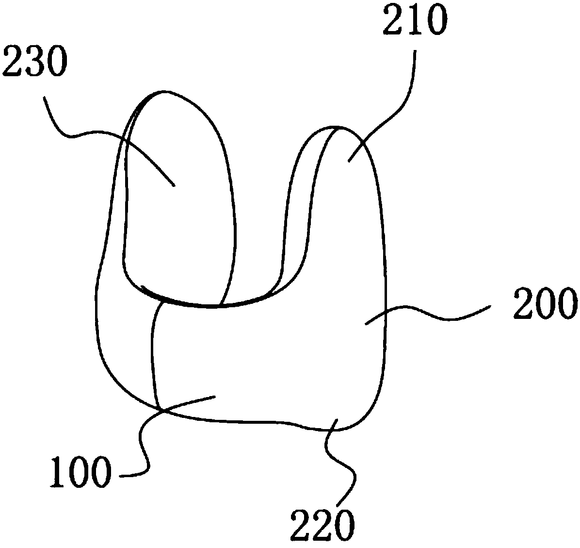 Harelip nasal columella retention clip