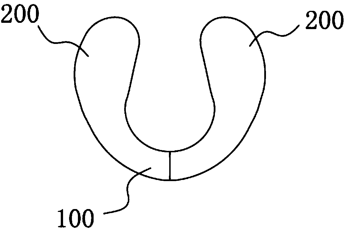 Harelip nasal columella retention clip