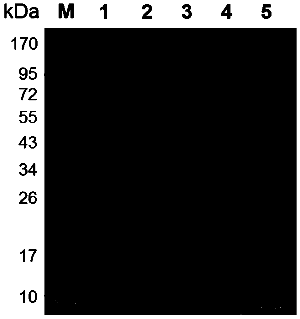 A kind of Schistosoma japonicum recombinant protein sjsaplp5 and its coding gene and application