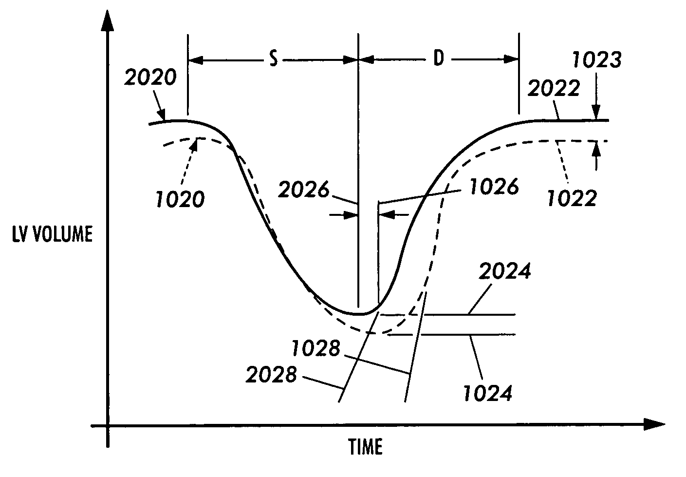 Method and apparatus for direct mechanical ventricular actuation with favorable conditioning and minimal heart stress