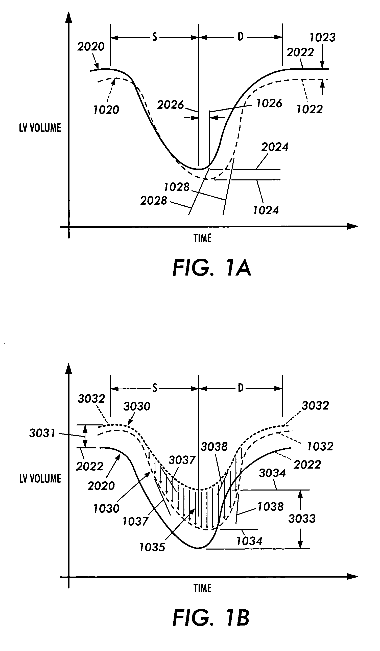 Method and apparatus for direct mechanical ventricular actuation with favorable conditioning and minimal heart stress