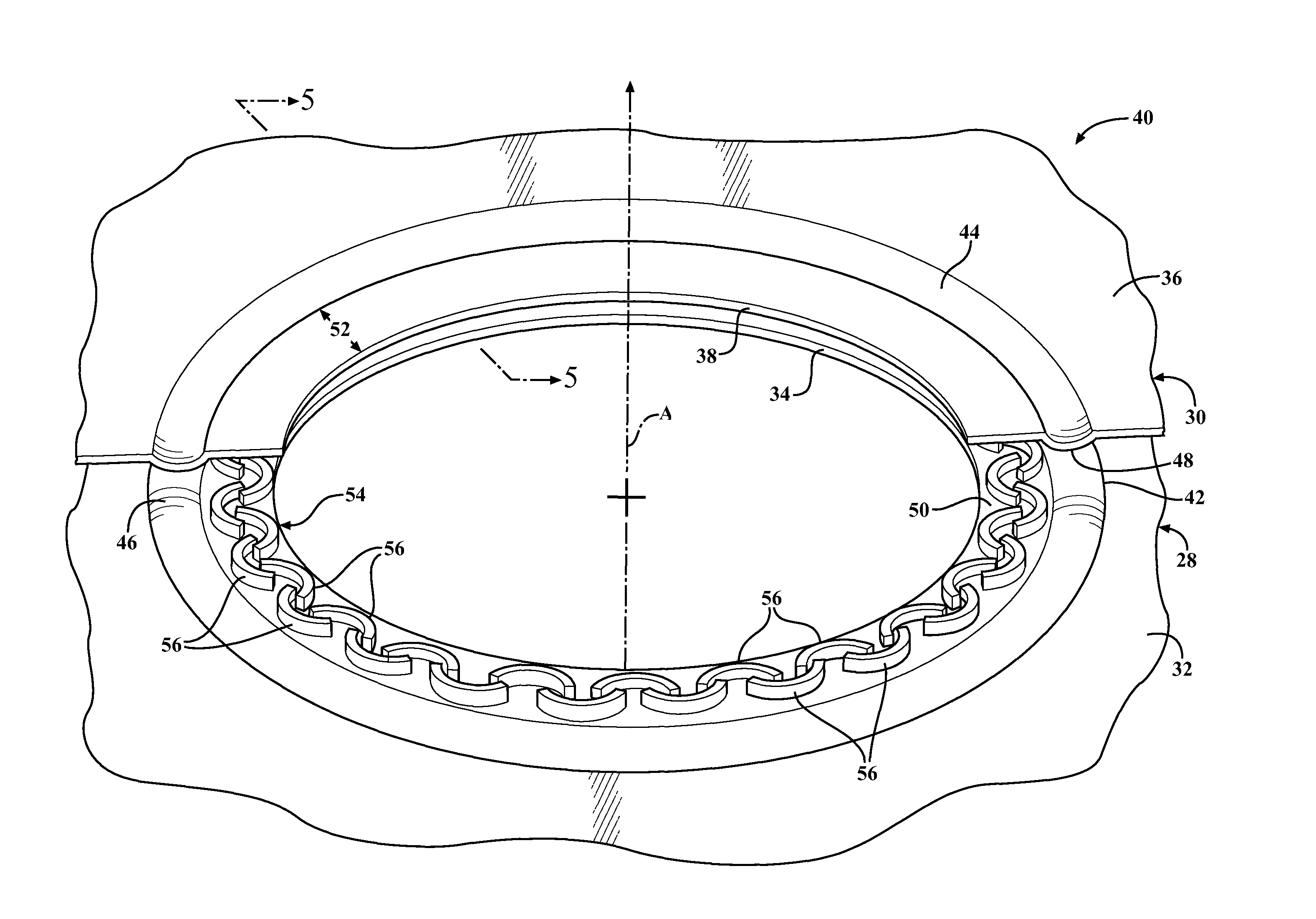 Multilayer gasket with segmented integral stopper feature