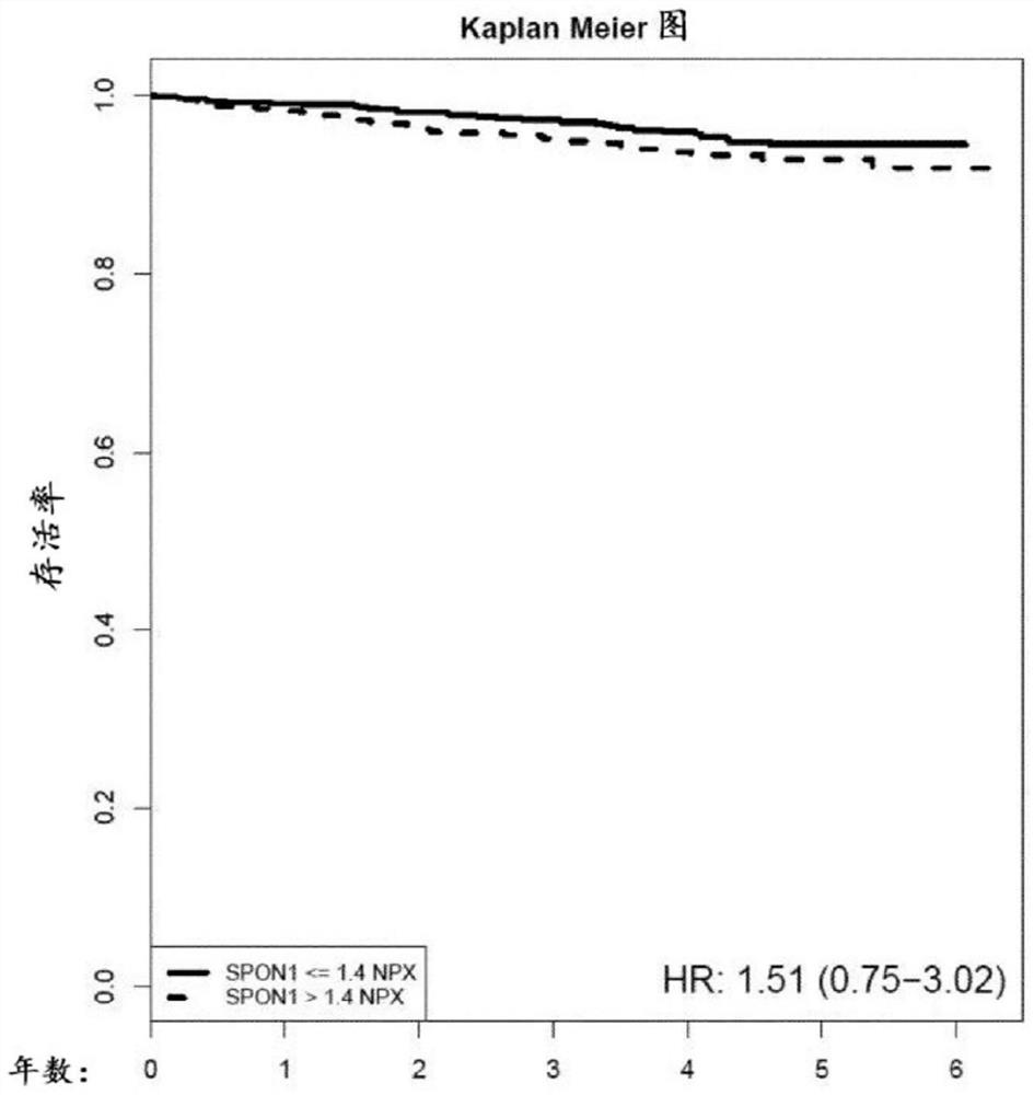 Circulating spon-1 (spondin-1) in the assessment of atrial fibrillation