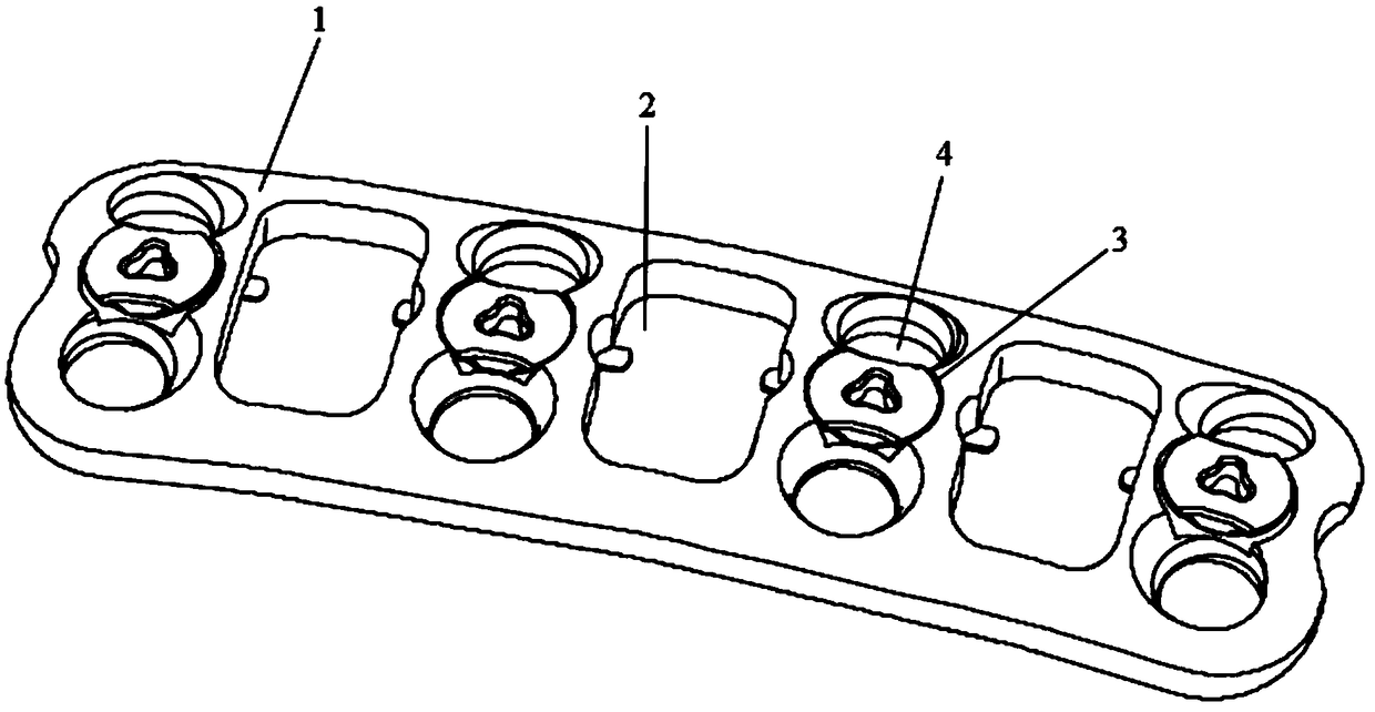 Anterior fixation fusion system for natural height of cervical vertebra