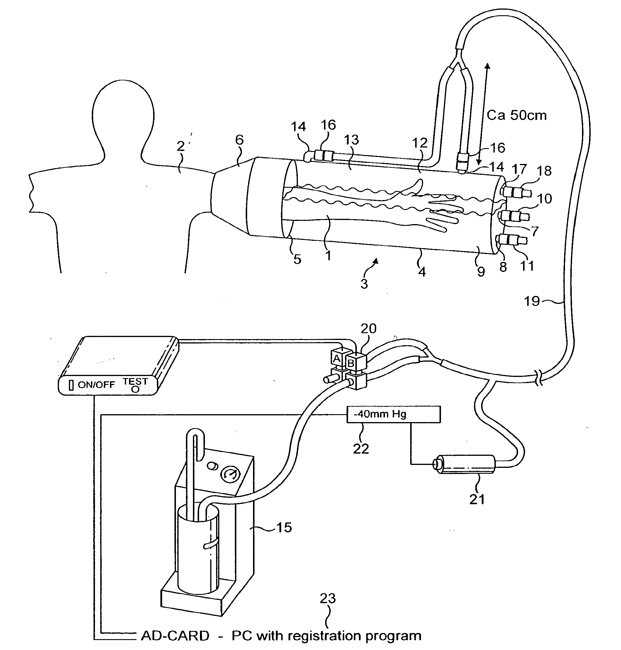 Device for applying a pulsating pressure to a local region of the body and the applications thereof