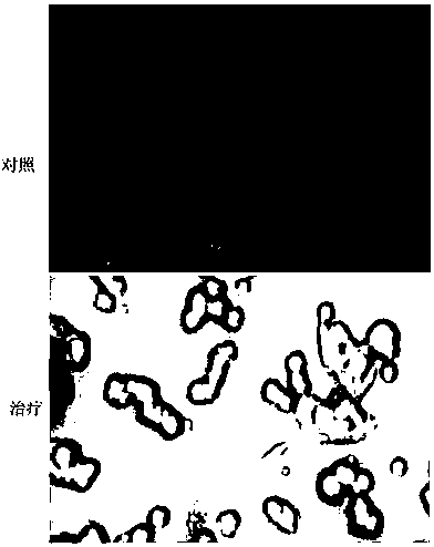 A highly tropic bladder cancer-targeted tumor-killing adenovirus