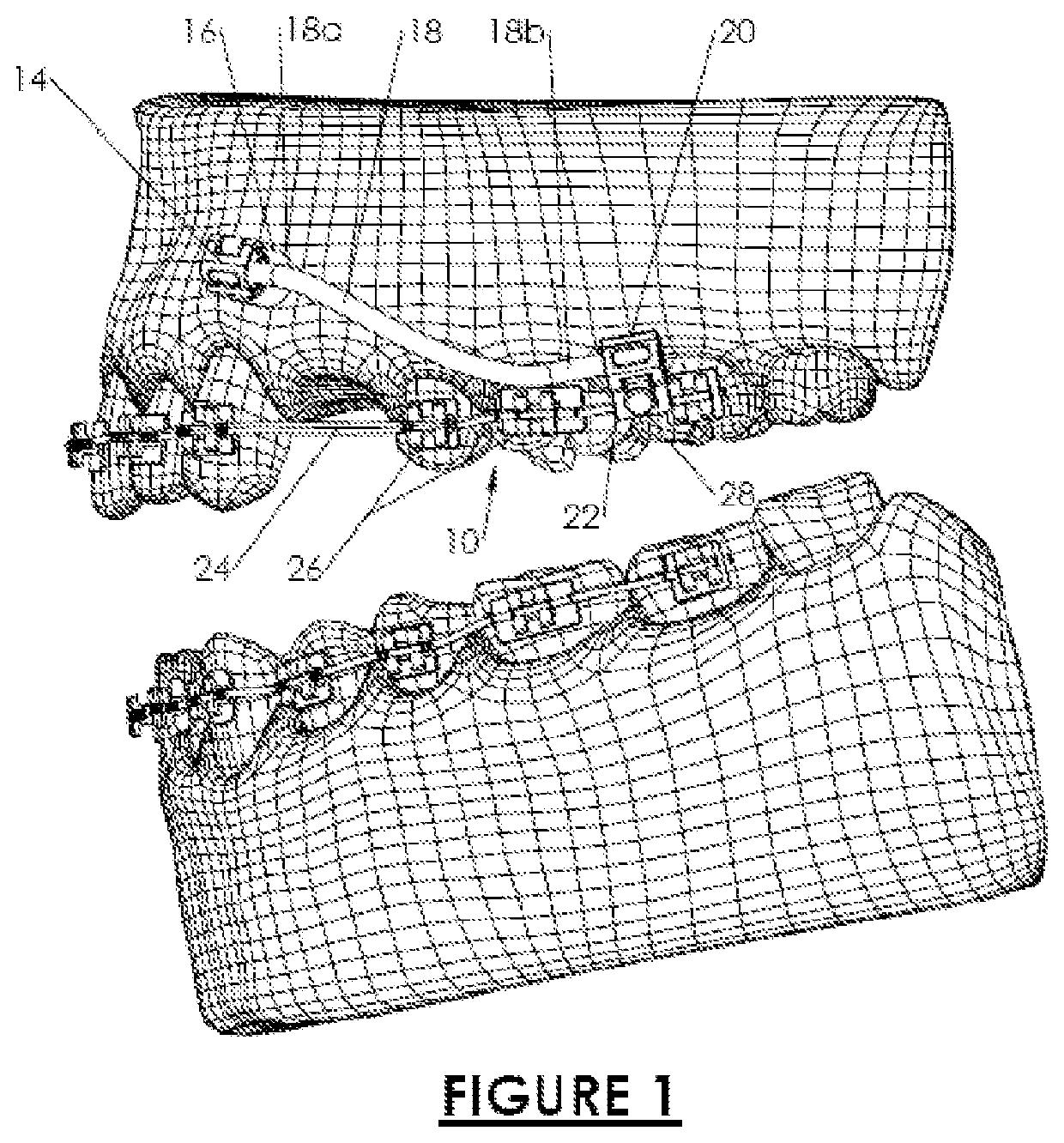 Orthodontic system anchoring method and apparatus