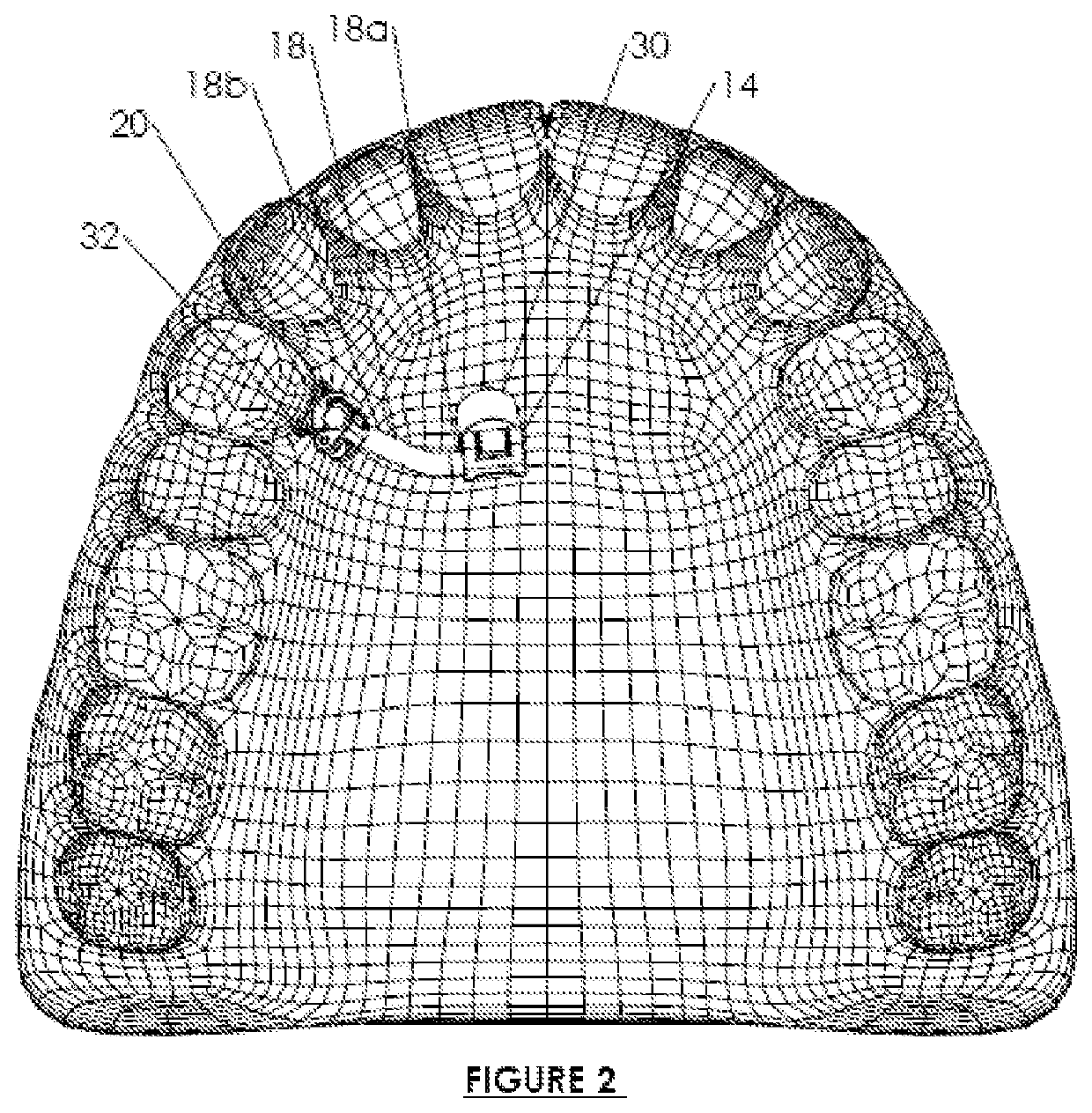 Orthodontic system anchoring method and apparatus