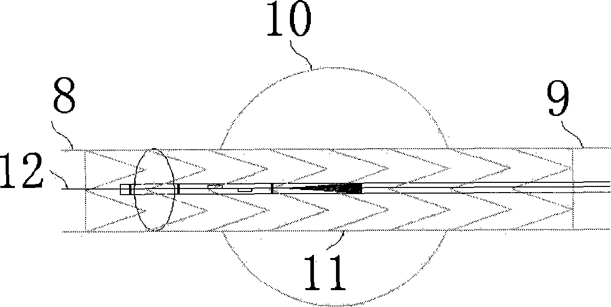 Sacculus conveyer